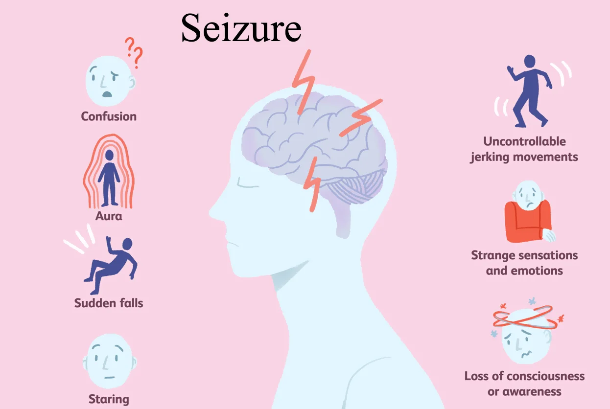 SEIZURE