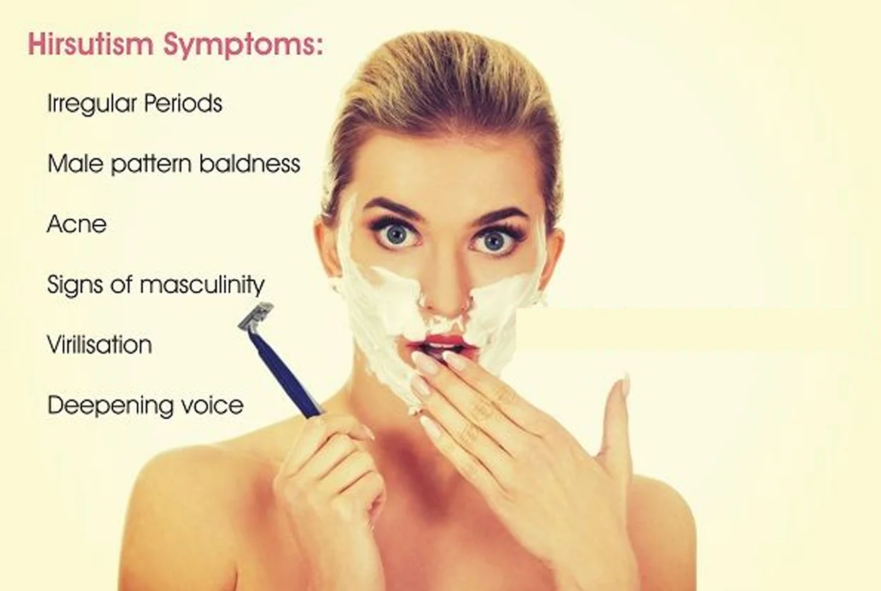 Hirsutism