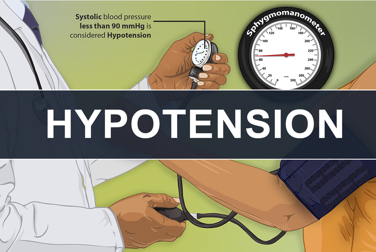 HYPOTENSION