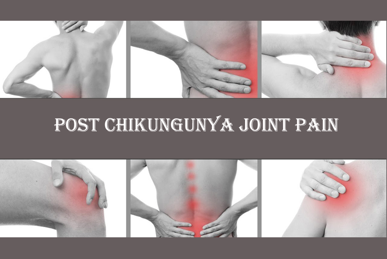 Post Chickenguniya Joint Pain