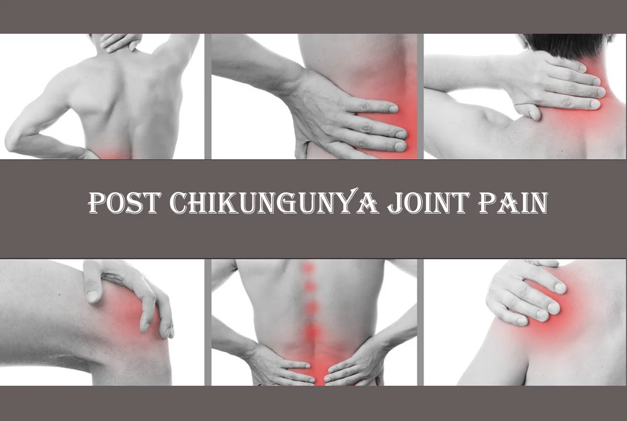 POST CHICKENGUNIYA JOINT PAIN