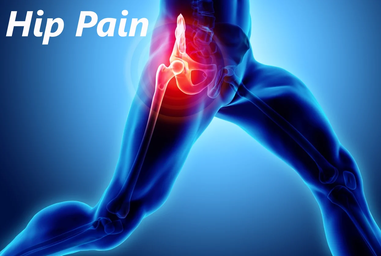 Hip Pain