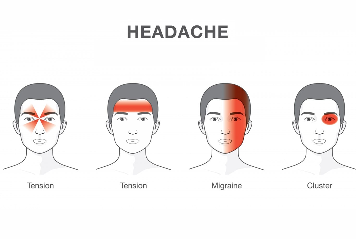 HEADACHE