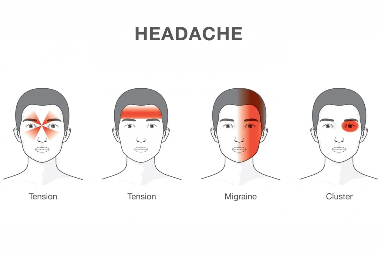 HEADACHE
